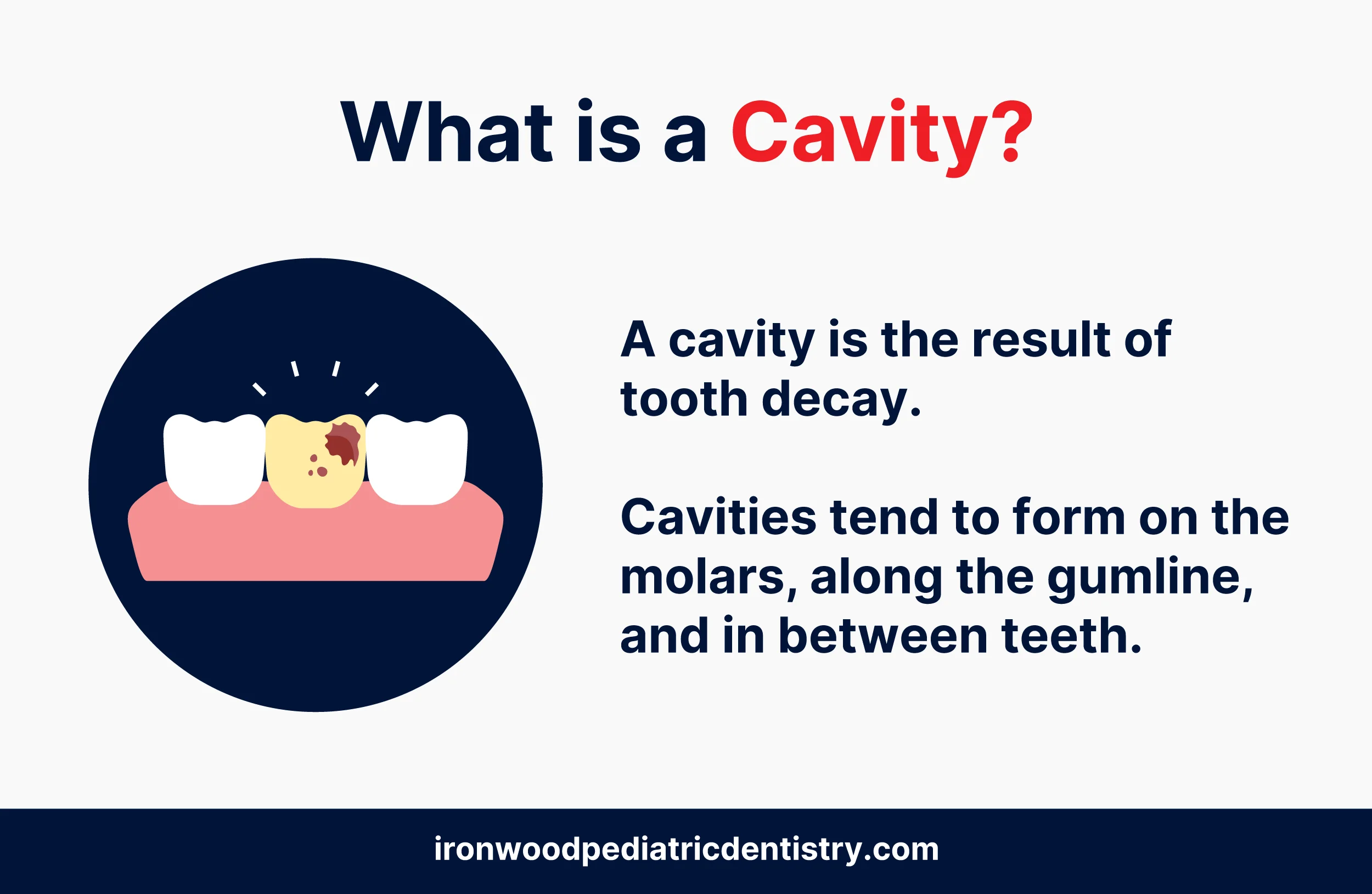 what is a cavity?