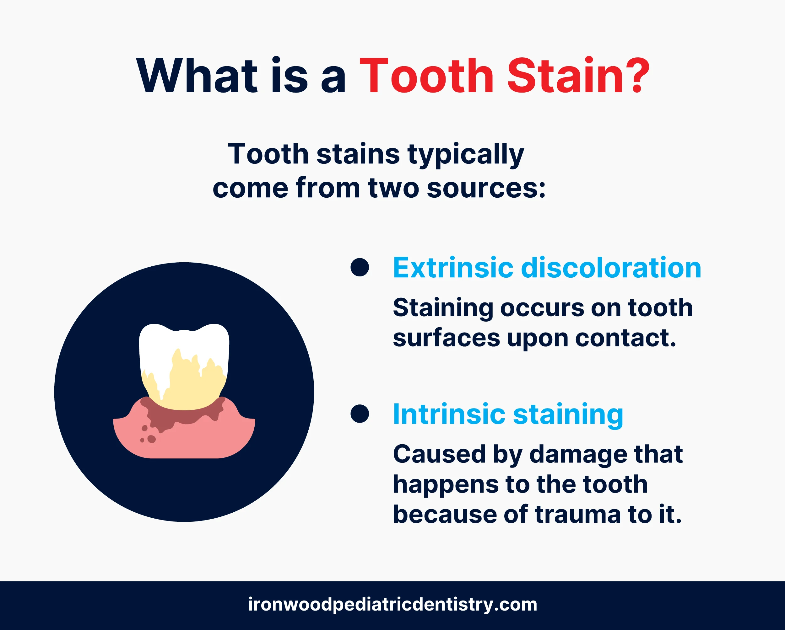 what is a tooth stain