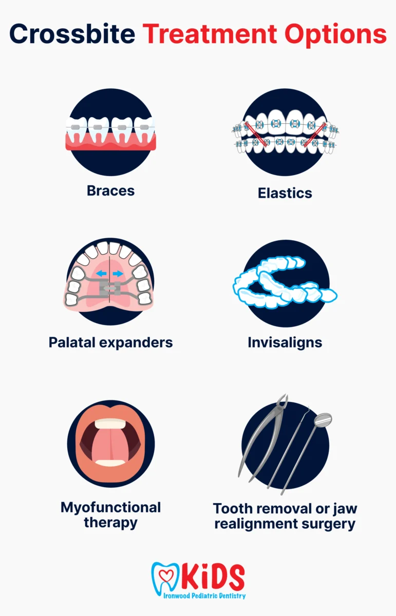 An infographic listing different crossbite treatment options.