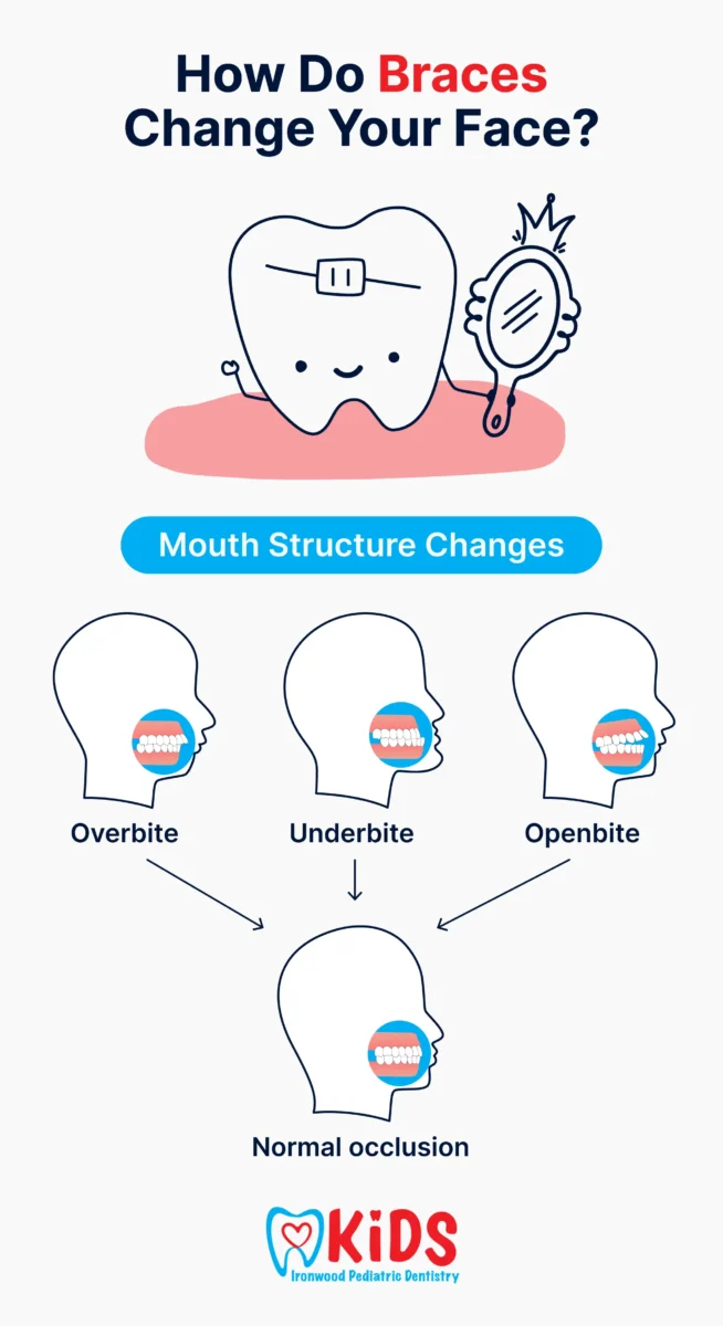 An infographic listing bite issues that braces fix. 