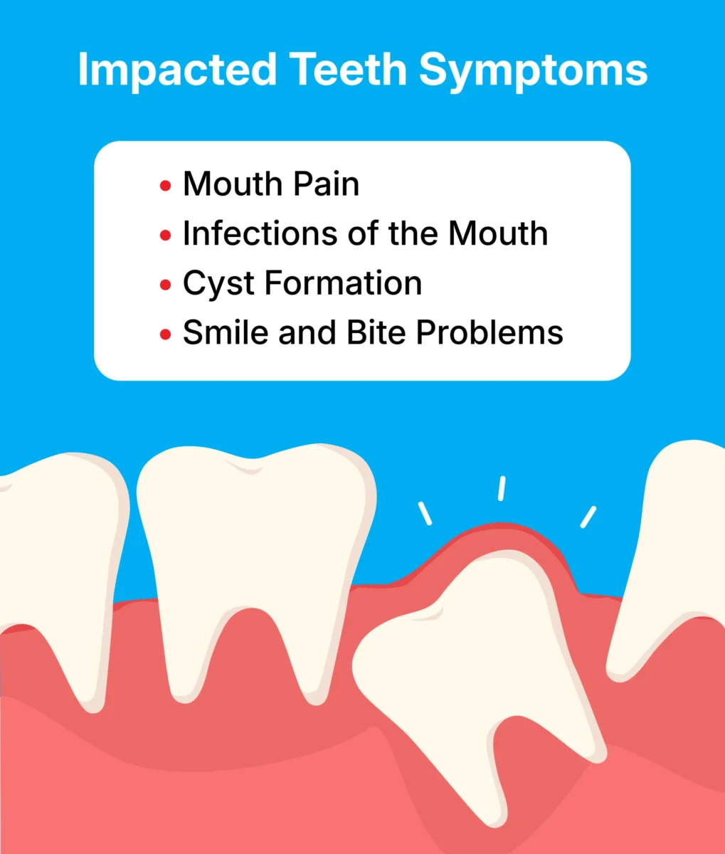 How Braces Help Fix Impacted Teeth