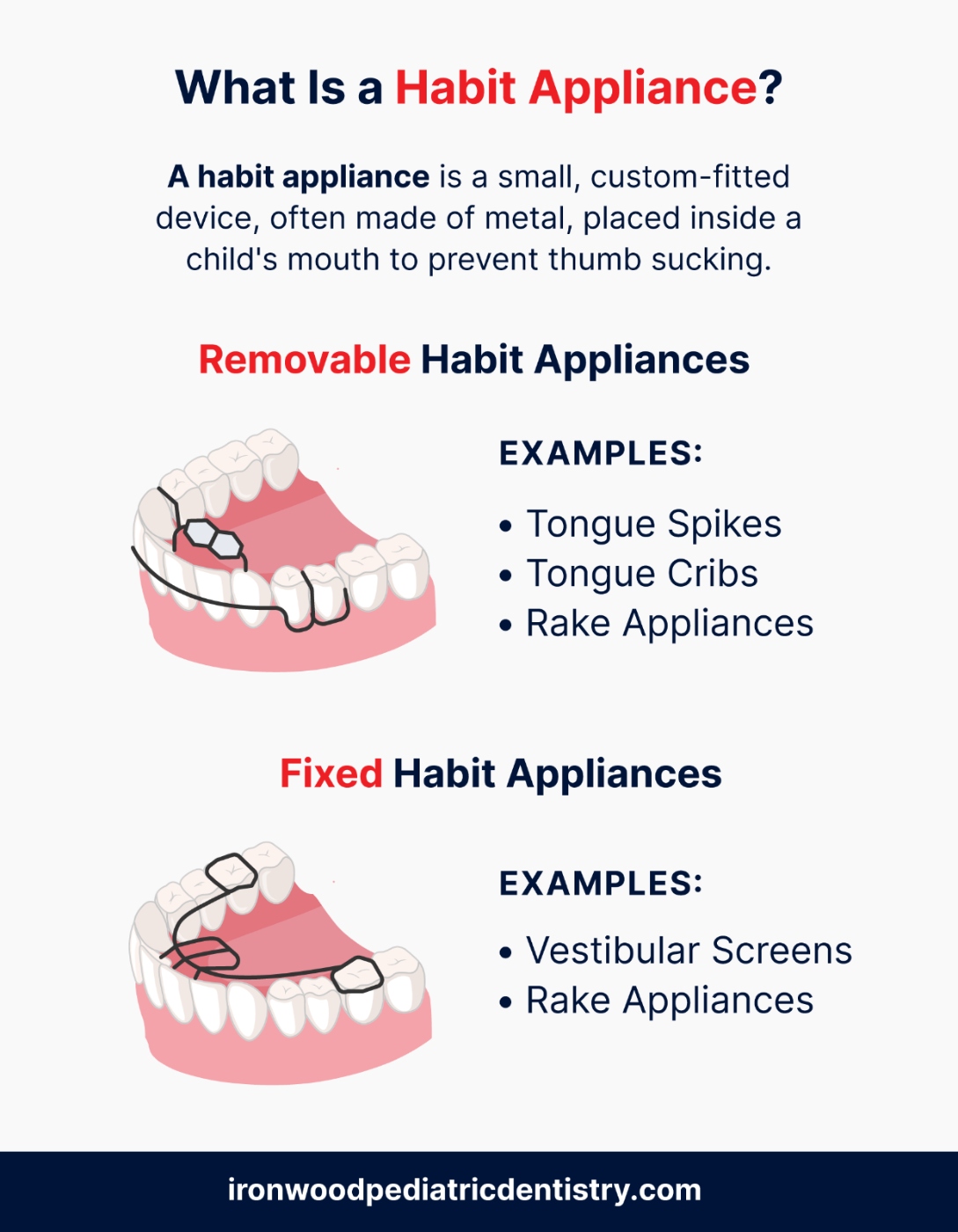 What is a habit appliance