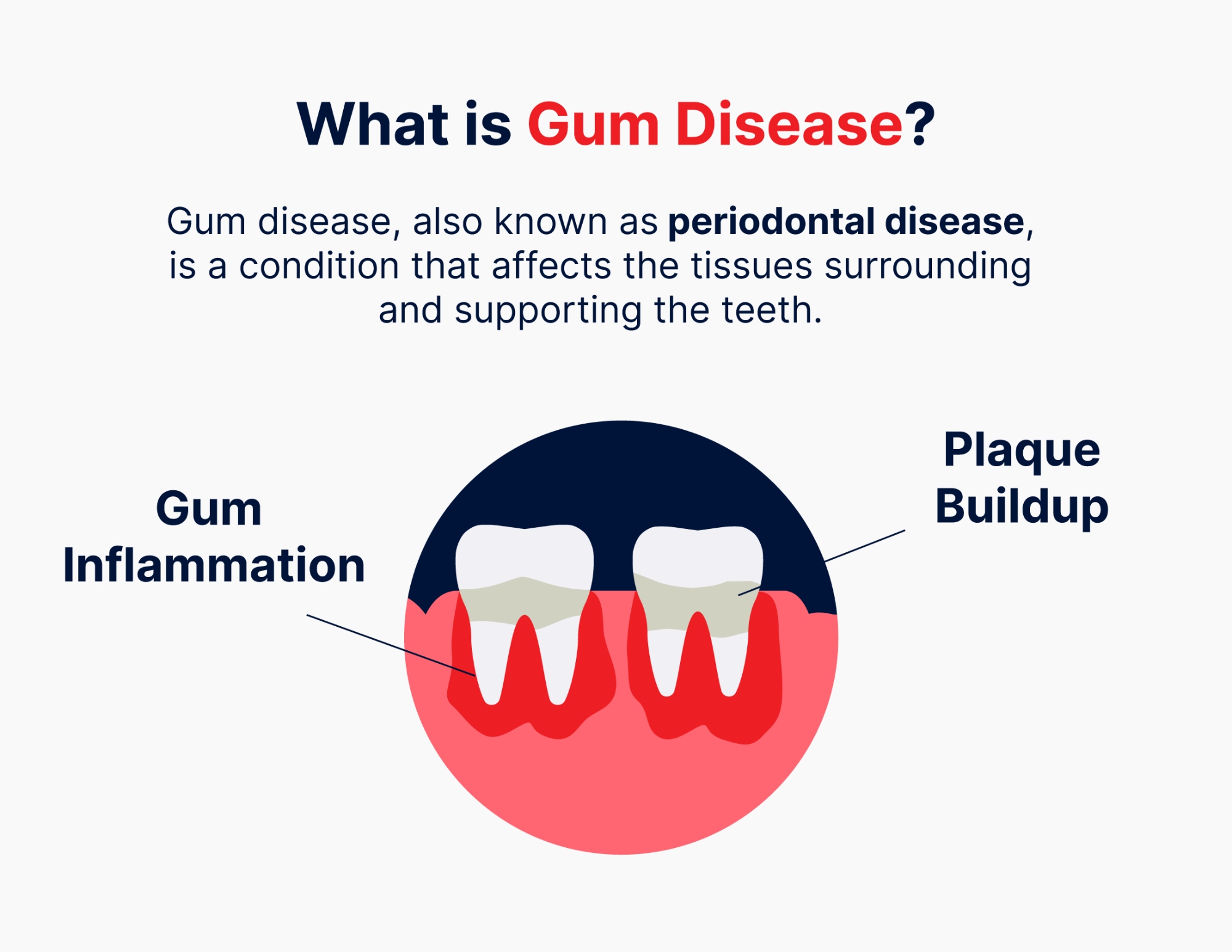 what is gum disease