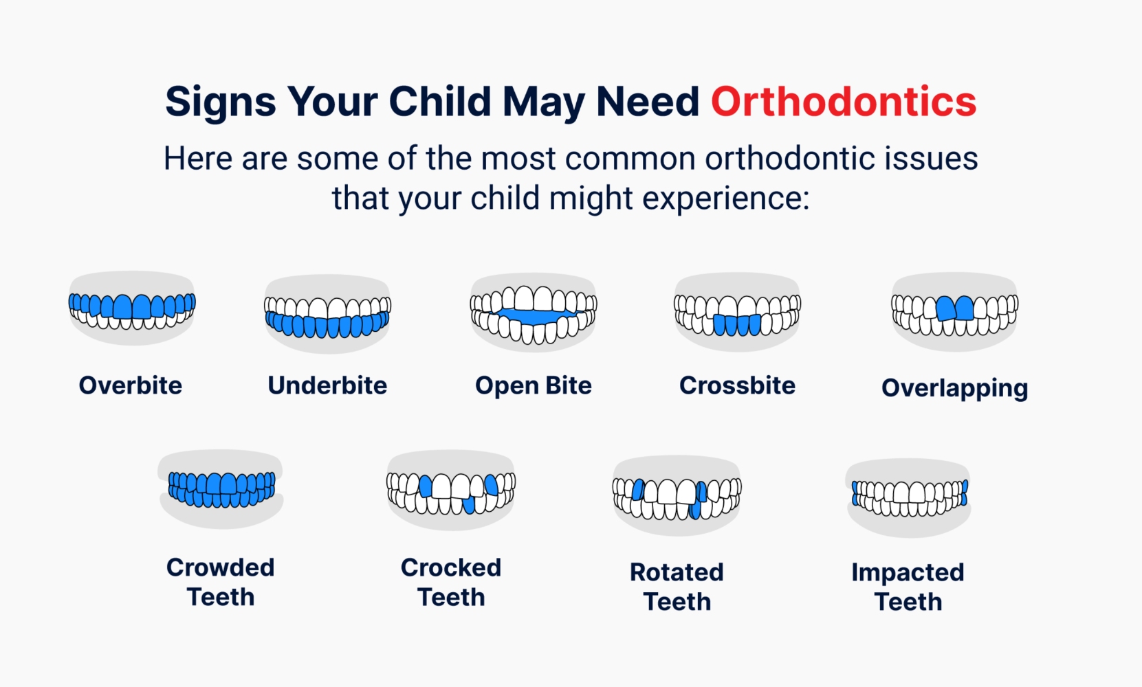 Signs your child may need orthodontics