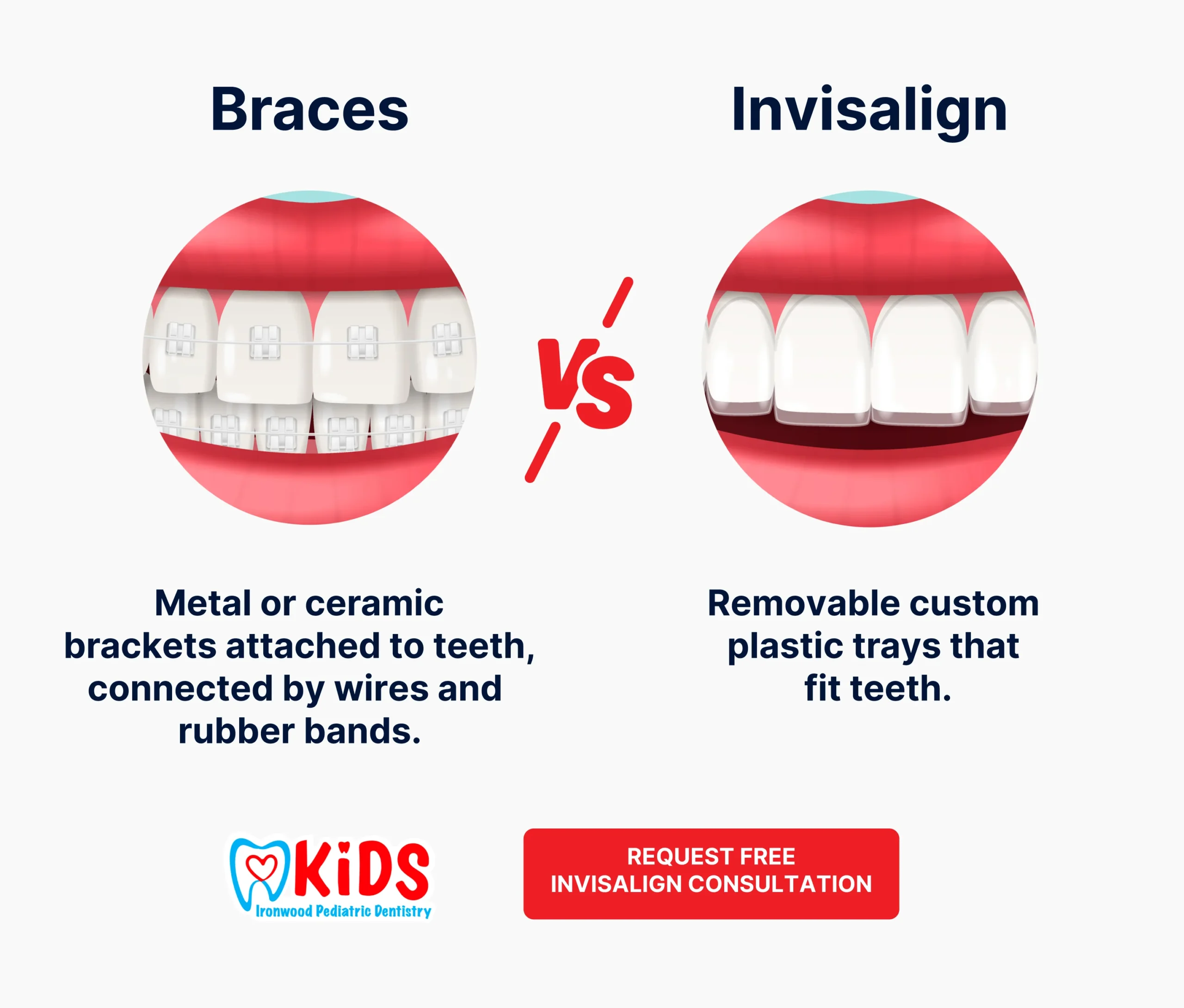 braces versus invisalign