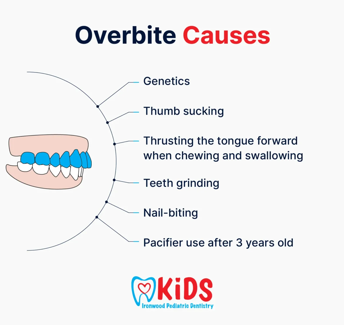 A custom graphic listing the causes of an overbite.