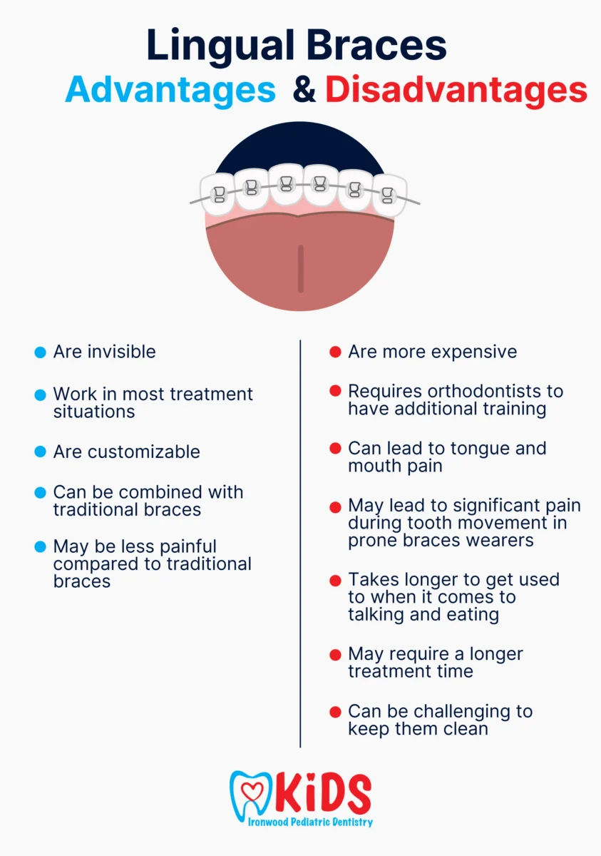 An infographic listing the advantages and disadvantages or lingual braces.