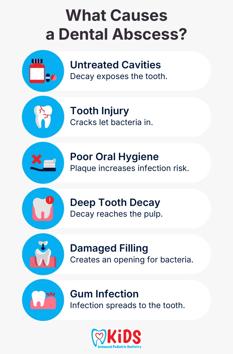 What Causes a Dental Abscess