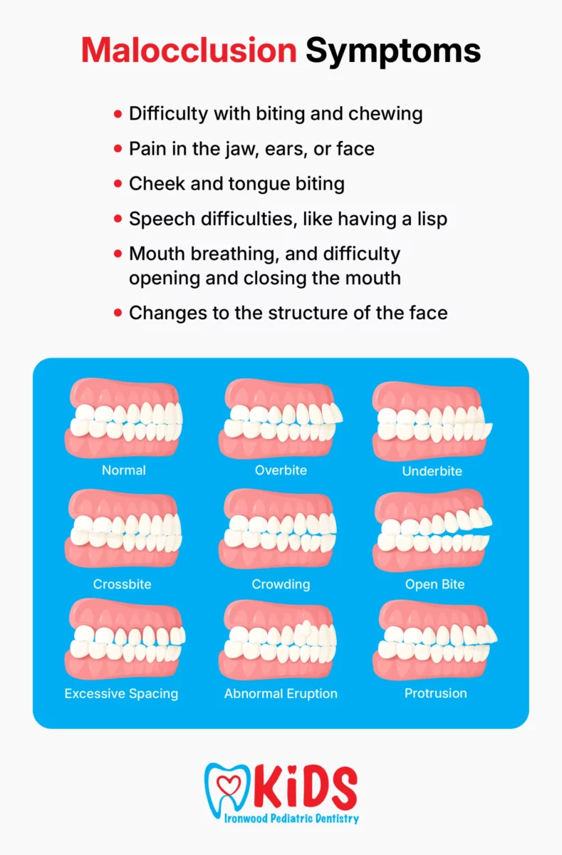 An infographic listing malocclusion symptoms.