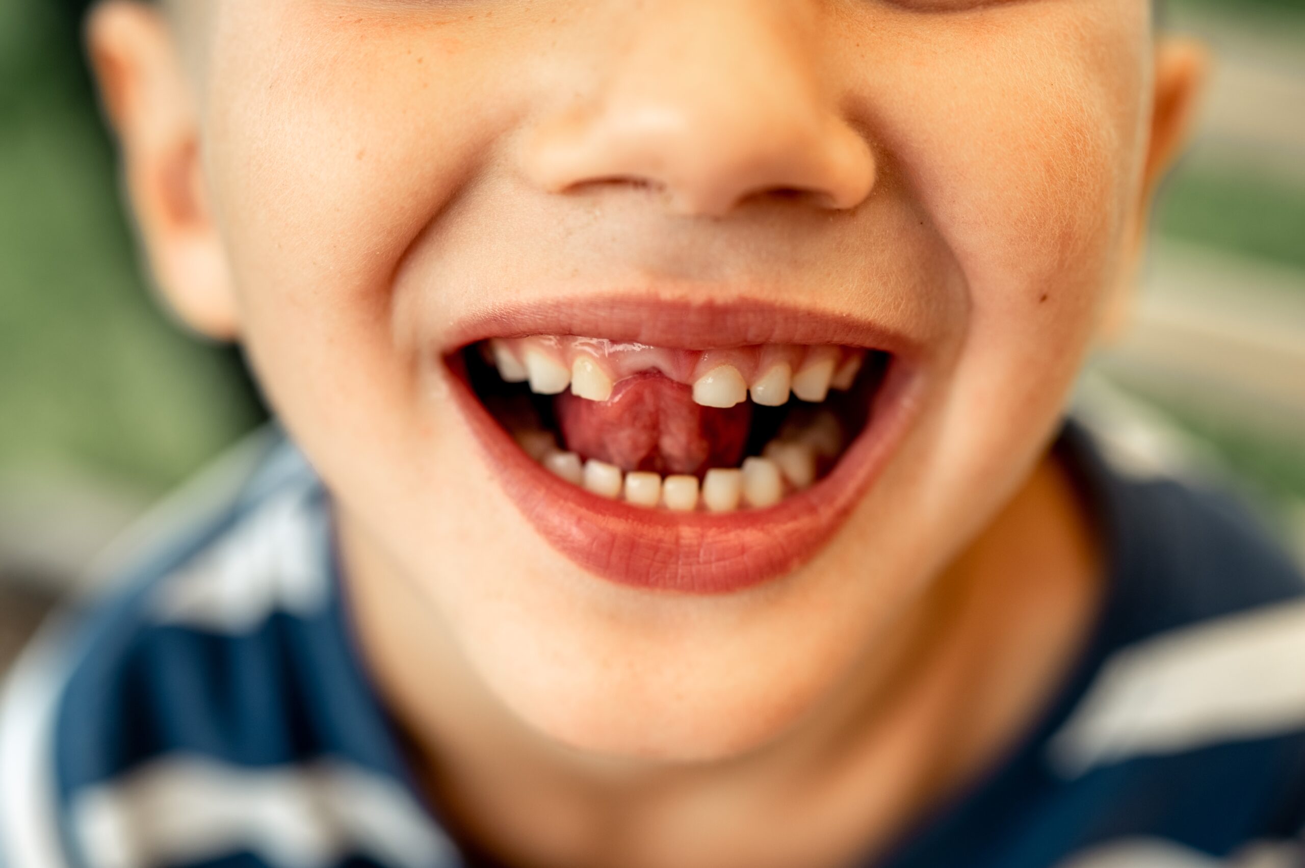 A child with misaligned teeth