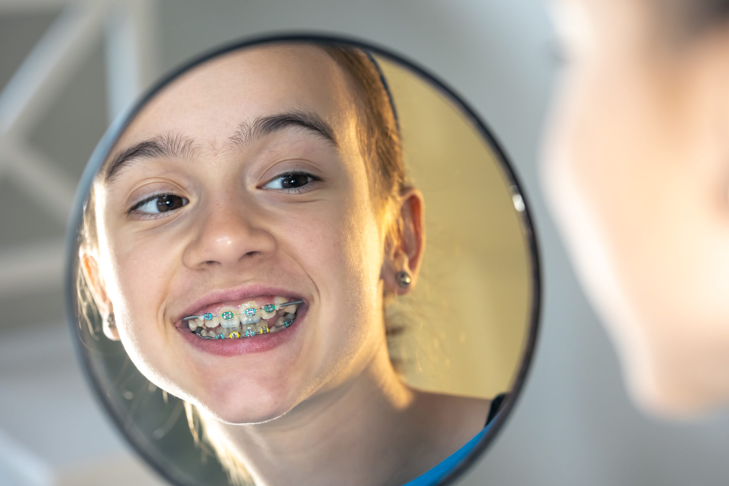 Preteen look at her braces in a mirror.