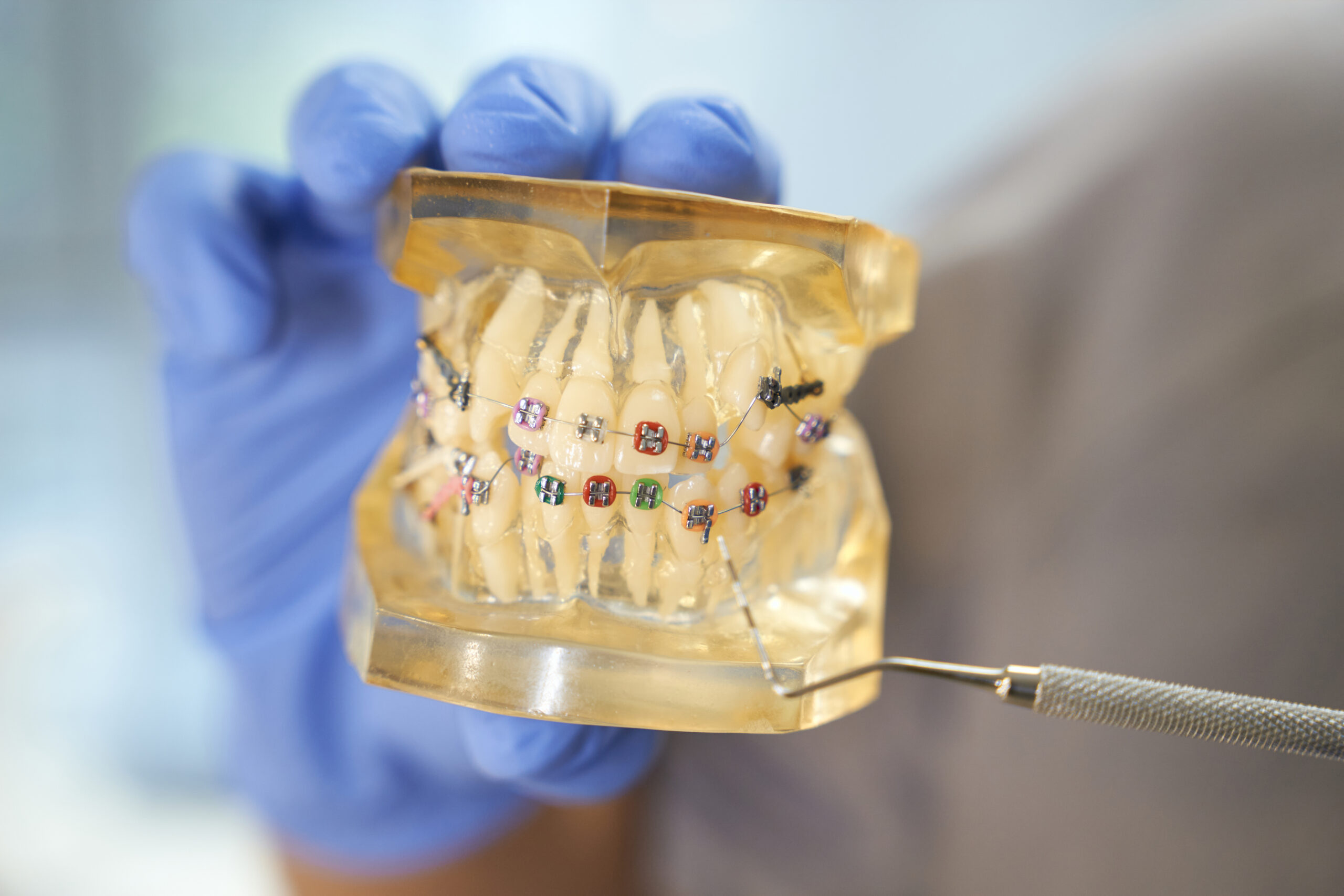 Dentist holding up model of teeth with braces.