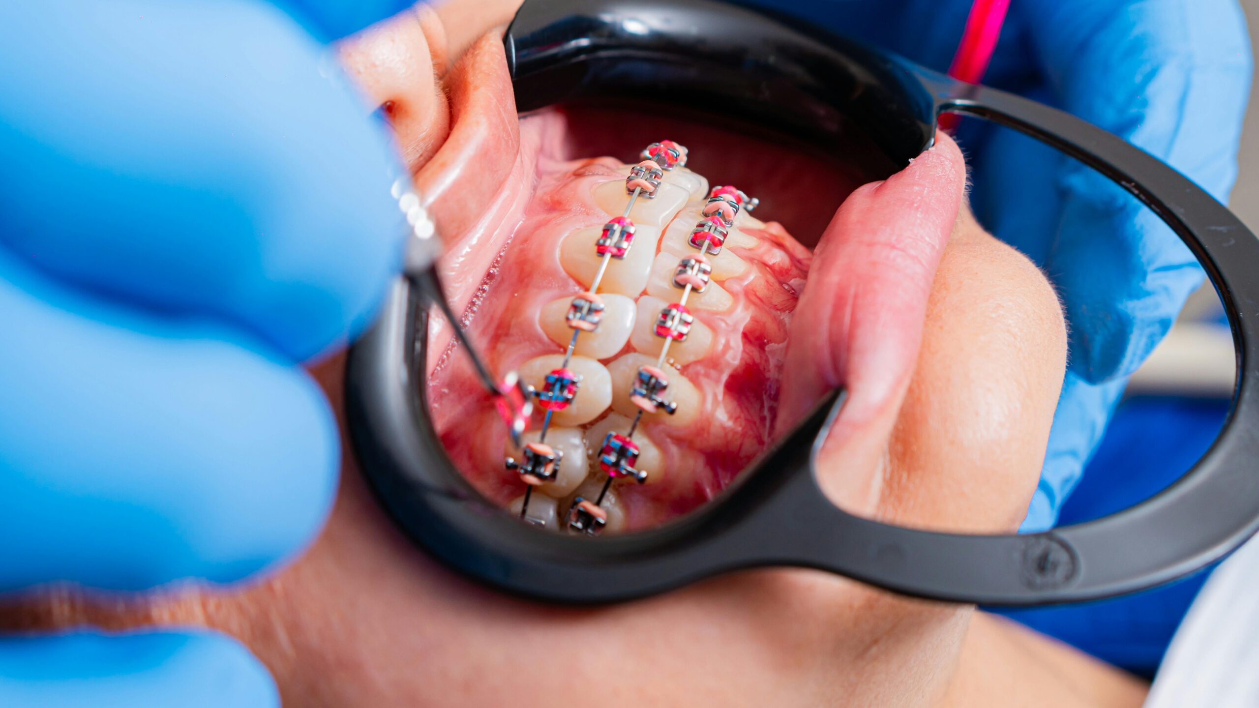 Child at Orthodontist