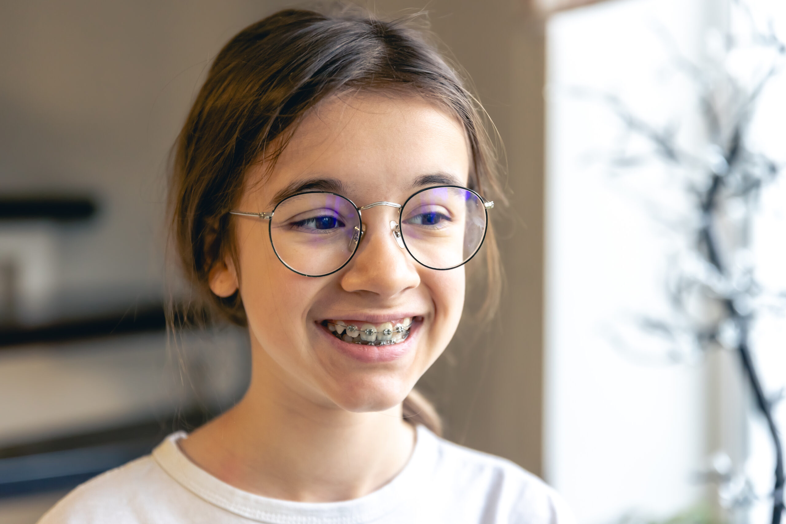 A girl treating overcrowded teeth with braces smiling.